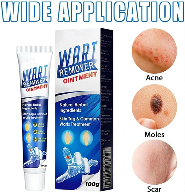Instant Wart-Remover Ointment ( 100g ) Buy 1 Get 1 Free